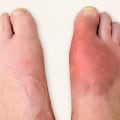 Expert Insights: The Impact of Foot Diseases on Your Health