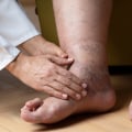 Expert Tips for Keeping Your Feet Healthy as You Age