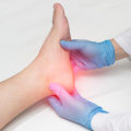 Expert Advice: Choosing Between a Podiatrist or Orthopedist for Achilles Tendonitis