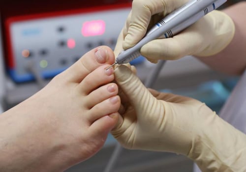 Why Podiatrists are More Than Just Foot Doctors