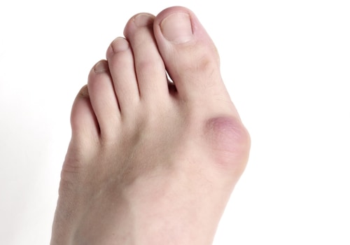 The Most Painful Foot Conditions: Expert Insights