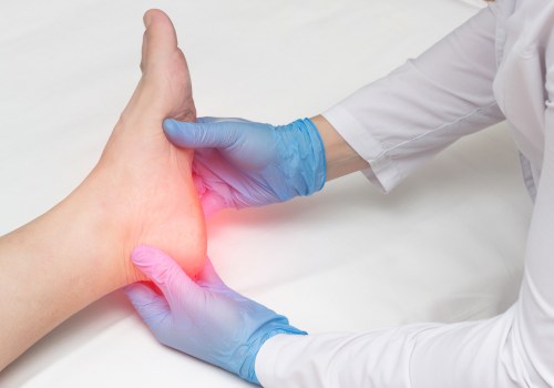 Expert Advice: Choosing Between a Podiatrist or Orthopedist for Achilles Tendonitis